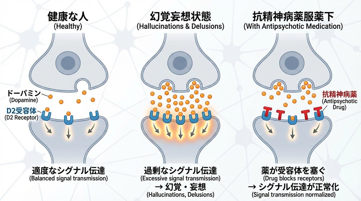 Dopamine and schizophrenia synapse diagram — example output
